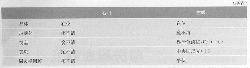 ZY016_150_1.gif